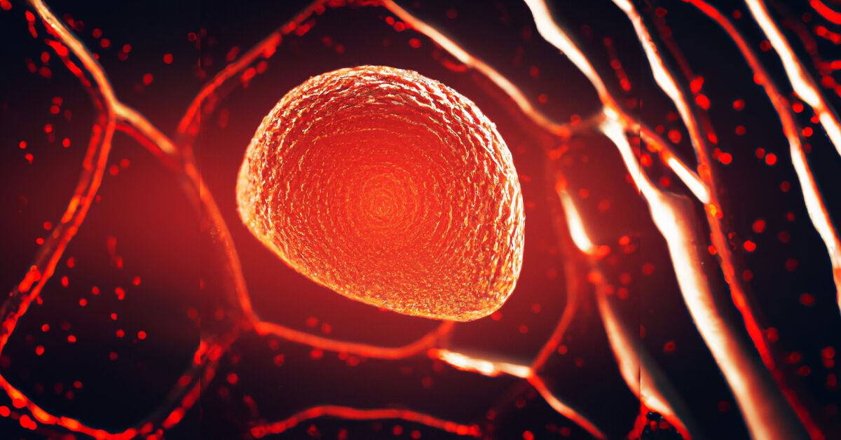 The Role of VLDL Cholesterol in Cardiovascular Diseases